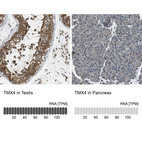 Anti-TMX4 Antibody