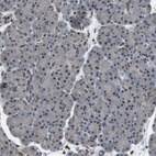 Anti-TMX4 Antibody