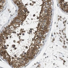 Immunohistochemical staining of human testis shows high expression.