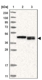 Anti-TMX4 Antibody