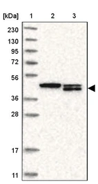 Lane 1: Marker [kDa] 230, 130, 95, 72, 56, 36, 28, 17, 11_br/_Lane 2: Human cell line RT-4_br/_Lane 3: Human cell line U-251MG sp