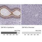 Anti-ZNF185 Antibody