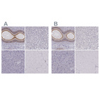 Immunohistochemical staining of human epididymis, liver, pancreas and skeletal muscle using Anti-ZNF185 antibody HPA000400 (A) shows similar protein distribution across tissues to independent antibody HPA016438 (B).