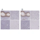 Immunohistochemical staining of human epididymis, liver, pancreas and skeletal muscle using Anti-ZNF185 antibody HPA000400 (A) shows similar protein distribution across tissues to independent antibody HPA016438 (B).