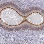 Immunohistochemical staining of human epididymis shows strong membranous positivity in glandular cells.