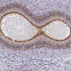 Immunohistochemical staining of human epididymis shows strong membranous positivity in glandular cells.