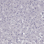 Immunohistochemical staining of human liver shows no positivity in hepatocytes as expected.