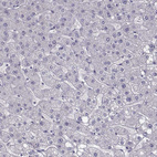 Anti-ZNF185 Antibody