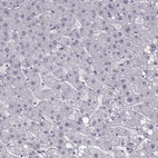 Immunohistochemical staining of human liver shows no positivity in hepatocytes as expected.