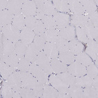 Immunohistochemical staining of human skeletal muscle shows no positivity in myocytes as expected.