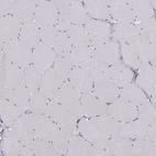 Immunohistochemical staining of human skeletal muscle shows no positivity in myocytes as expected.