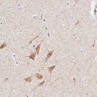 Anti-CLCN5 Antibody