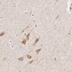 Anti-CLCN5 Antibody