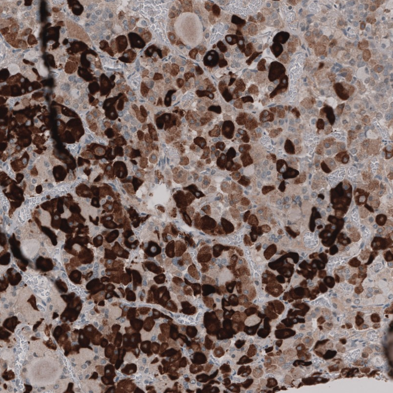 Anti-KIAA2022 Antibody