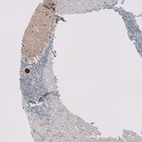 Immunohistochemical staining of human cerebellum shows strong cytoplasmic positivity in Purkinje cells.