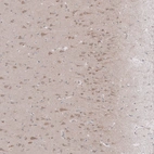 Immunohistochemical staining of human cerebral cortex shows moderate cytoplasmic positivity in neuronal cells.