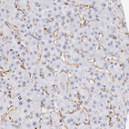 Immunohistochemical staining of human liver shows no positivity in hepatocytes as expected.