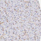 Anti-KIAA2022 Antibody