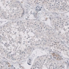 Immunohistochemical staining of human testis shows no cytoplasmic positivity in cells in seminiferous ducts as expected.