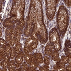 Immunohistochemical staining of human stomach shows strong cytoplasmic positivity in glandular cells.