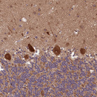 Anti-ARHGAP12 Antibody