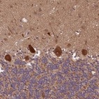 Immunohistochemical staining of human cerebellum shows strong cytoplasmic positivity in Purkinje cells.