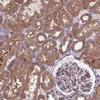 Immunohistochemical staining of human kidney shows moderate cytoplasmic positivity in cells in tubules.