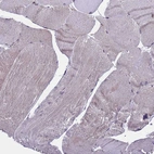 Immunohistochemical staining of human skeletal muscle shows no positivity in myocytes as expected.