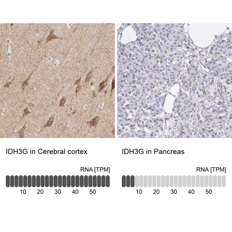 Anti-IDH3G Antibody