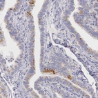 Immunohistochemical staining of human fallopian tube shows weak to moderate granular cytoplasmic positivity in glandular cells.