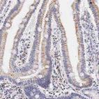 Immunohistochemical staining of human duodenum shows moderate granular cytoplasmic positivity in glandular cells.