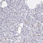 Anti-IDH3G Antibody