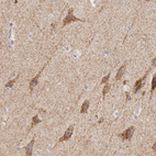 Anti-IDH3G Antibody