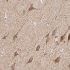 Immunohistochemical staining of human cerebral cortex shows moderate granular cytoplasmic positivity in neuronal cells.