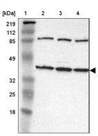 Lane 1: Marker [kDa] 219, 112, 85, 49, 32, 25, 18_br/_Lane 2: Human cell line RT-4_br/_Lane 3: Human cell line U-251MG sp_br/_Lane 4: Human cell line A-431