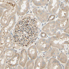 Immunohistochemical staining of human kidney shows moderate cytoplasmic positivity in cells in glomeruli.