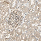 Immunohistochemical staining of human kidney shows moderate cytoplasmic positivity in cells in glomeruli.