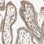 Immunohistochemical staining of human placenta shows moderate cytoplasmic positivity in trophoblastic cells.
