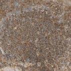 Immunohistochemical staining of human tonsil shows moderate cytoplasmic positivity in germinal center cells.