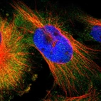 Immunofluorescent staining of human cell line U-251 MG shows localization to cytosol.