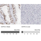 Anti-CSTF2 Antibody