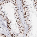 Immunohistochemical staining of human testis shows high expression.