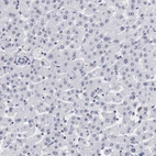 Immunohistochemical staining of human liver shows low expression as expected.