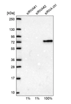 Western blot analysis in U2OS cells transfected with control siRNA, target specific siRNA probe #1 and #2, using Anti-CSTF2 antibody. Remaining relative intensity is presented