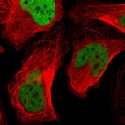 Anti-CSTF2 Antibody