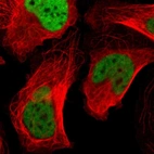 Immunofluorescent staining of human cell line U-2 OS shows localization to nucleoplasm.