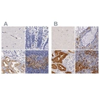 Immunohistochemical staining of human cerebral cortex, colon, kidney and lymph node using Anti-RENBP antibody HPA000428 (A) shows similar protein distribution across tissues to independent antibody HPA000522 (B).