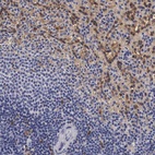 Anti-RENBP Antibody