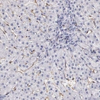 Immunohistochemical staining of human liver shows low expression as expected.