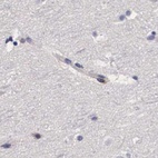 Immunohistochemical staining of human cerebral cortex using Anti-RENBP antibody HPA000428.